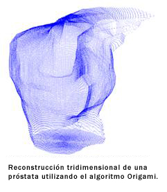 Radioterapia adaptativa